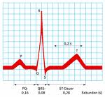 Ruhe-EKG